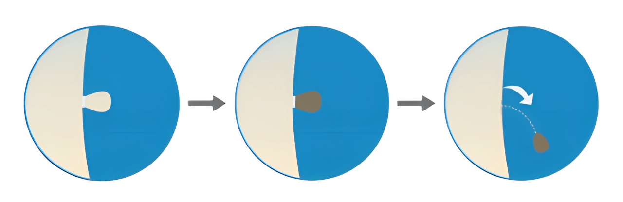 Ortoplus